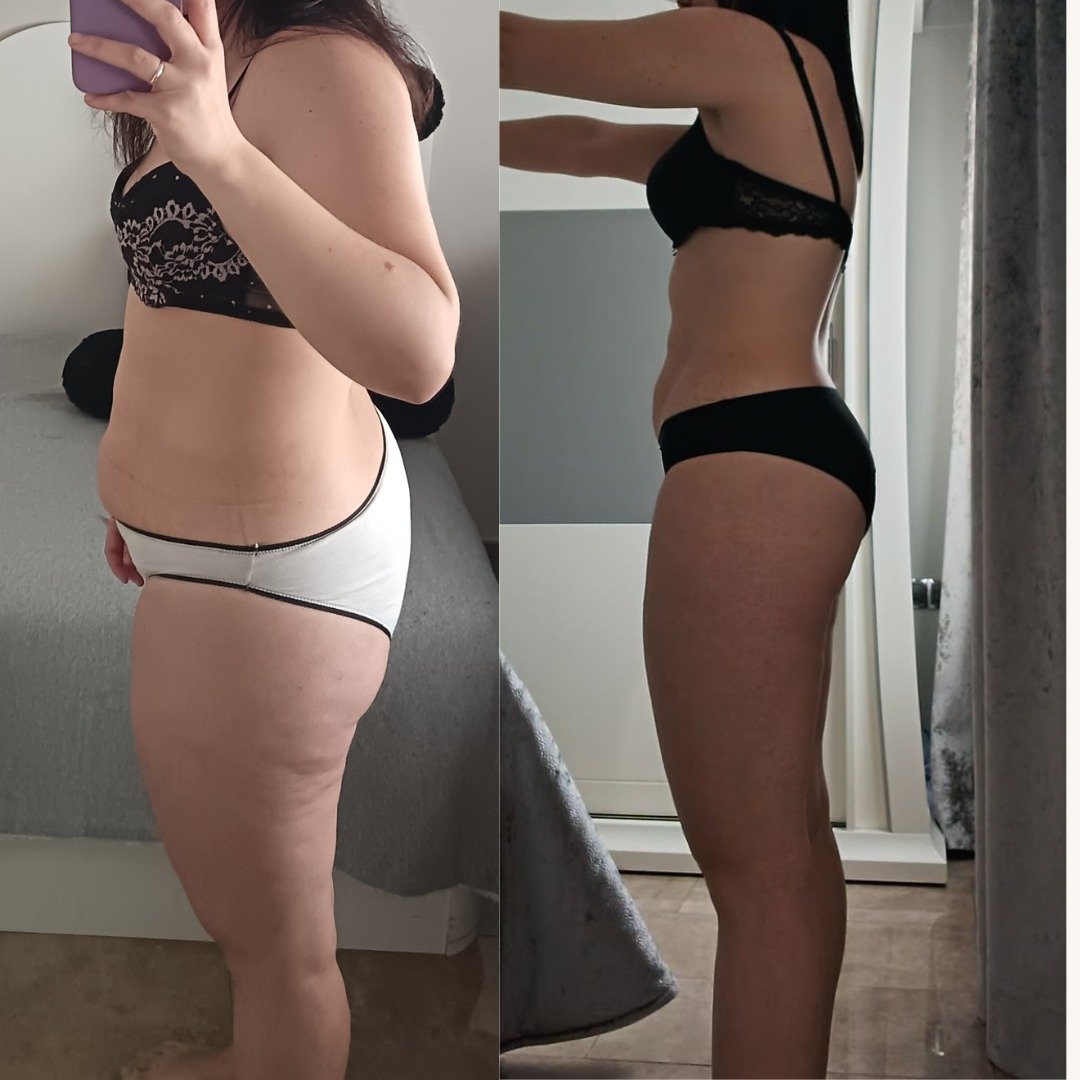 Transformación 10