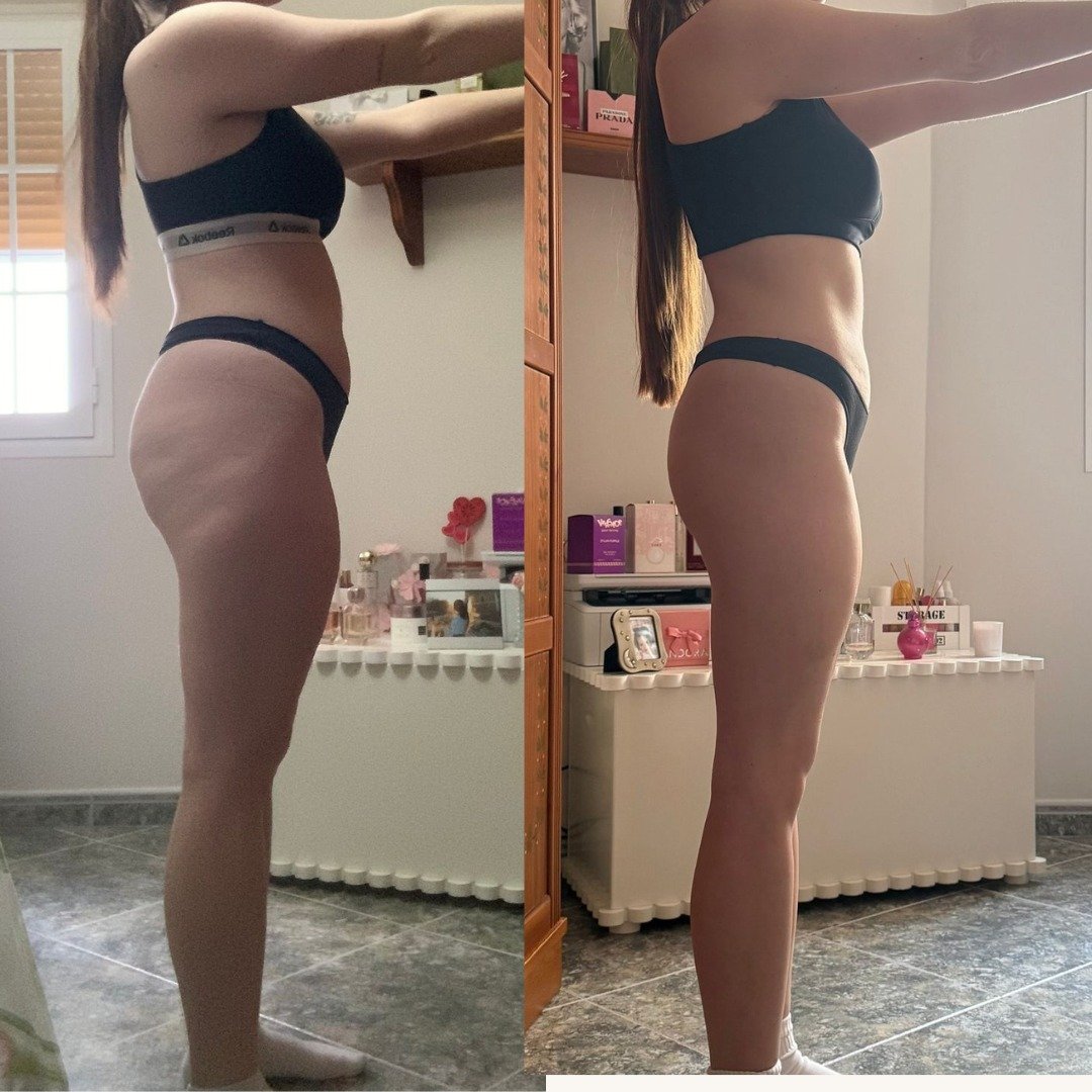 Transformación 7